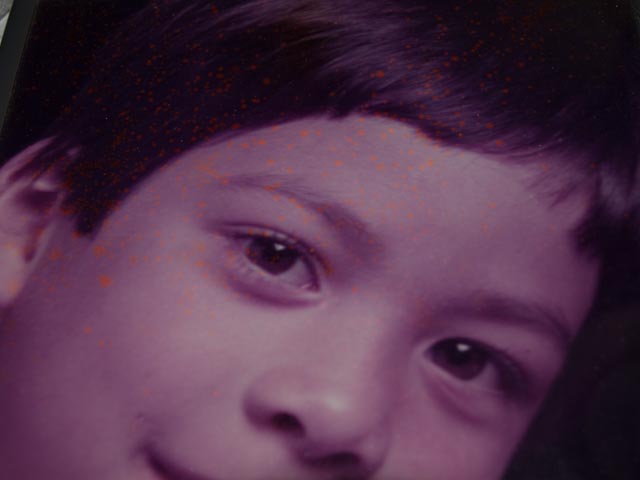 Chromogenic dye staining on a photo of a child