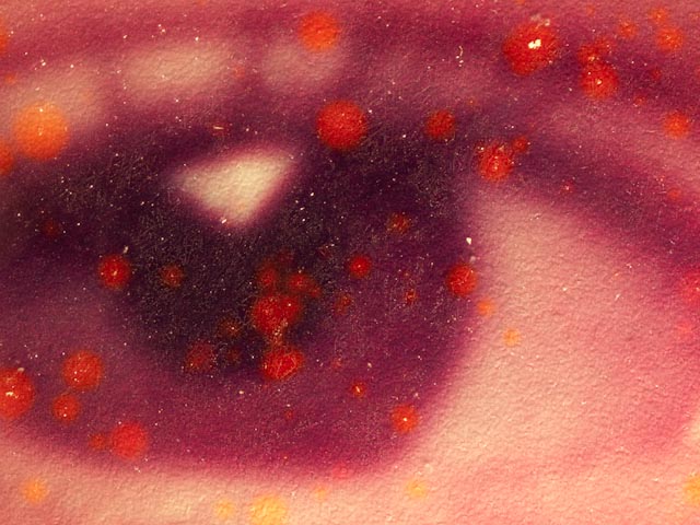 Chromogenic dye staining
